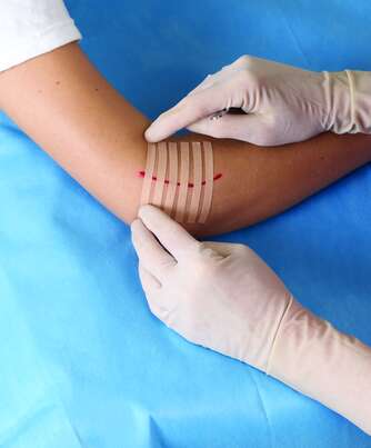 Sie sehen eine Packung Nexcare™ Steri-Strip™ Wundverschlussstreifen, braun, 6 mm x 75 mm 6/Packung, Produktbild: 03 Nexcare™ Steri-Strip™ Wundverschlussstreifen, braun, 6 mm x 75 mm 6/Packung, A-Nr.: 5738029 - 03